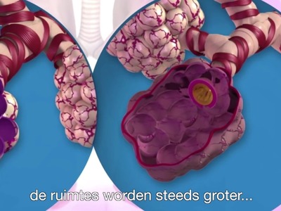 5 vragen van COPD- en coronapatiënt Jos Pielage aan stamcelbioloog Hans Clevers over mini-longen